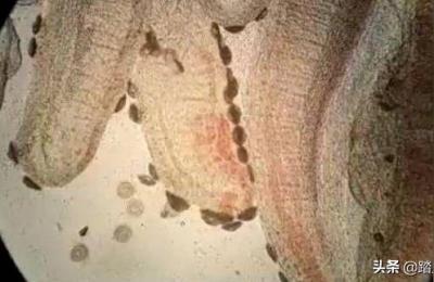 小砂车轮虫,鱼塘杀车轮虫要几天才能施肥
